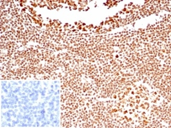 NCL Antibody