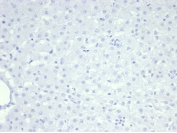 NCL Antibody