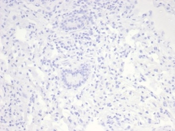 NCL Antibody