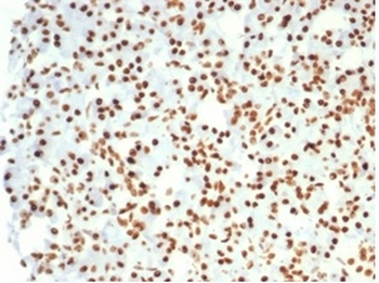 NCL Antibody
