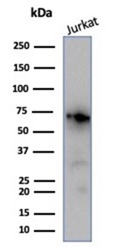 NCL Antibody