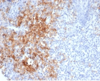 Recombinant CD38 (ADP Ribosyl Cyclase I) Antibody