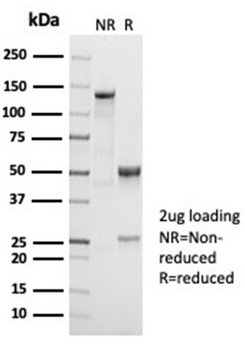 Recombinant CD38 (ADP Ribosyl Cyclase I) Antibody