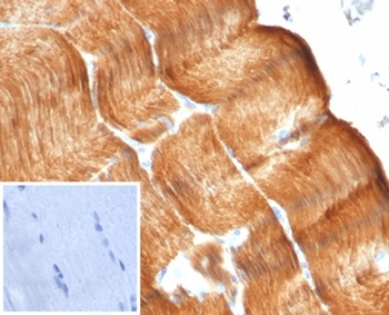 ACTN2 Antibody