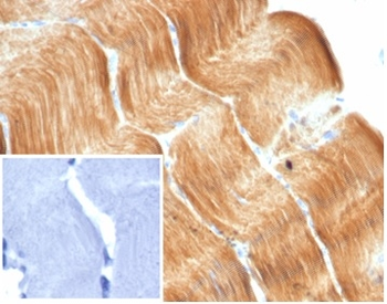 ACTN2 Antibody