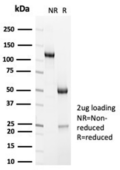 ACTN2 Antibody