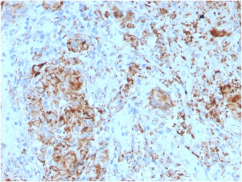 HAVCR2 Antibody