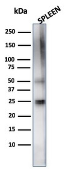 HAVCR2 Antibody