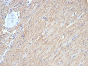 CALD1 Antibody