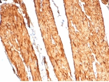 CALD1 Antibody