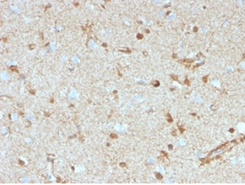 S100B Antibody