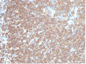 Recombinant CD45RA / LCA (B-Cell Marker) Antibody