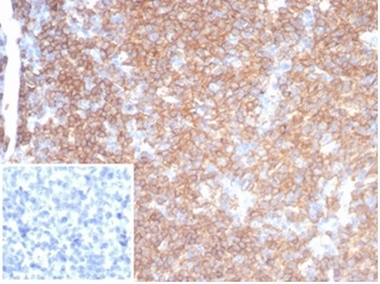 Recombinant CD45RA / LCA (B-Cell Marker) Antibody