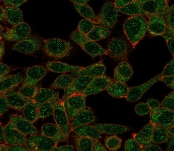 POLE3 Antibody