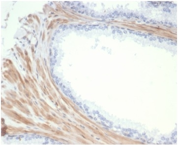 PGM5 Antibody