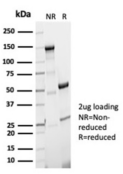 PGM5 Antibody