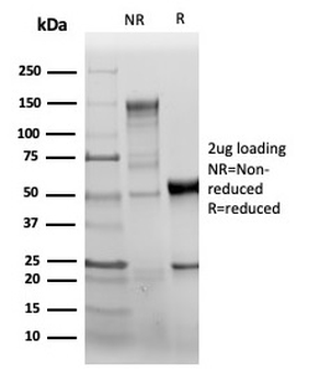 Recombinant CD31 / PECAM-1 (Endothelial Cell Marker) Antibody