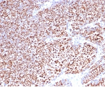 PGR Antibody