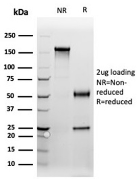 PGR Antibody