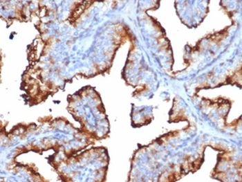 CD10 (Membrane Metalloendopeptidase) Antibody