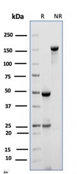 CD10 (Membrane Metalloendopeptidase) Antibody