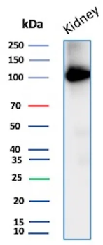 CD10 (Membrane Metalloendopeptidase) Antibody