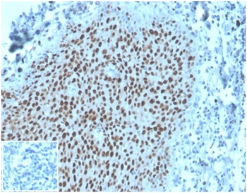 MCM2 Antibody
