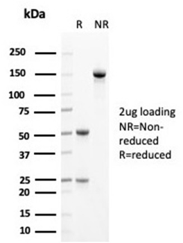 KRT14 Antibody