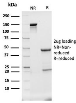 HP Antibody