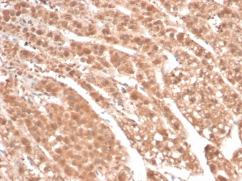 AKR1B1 Antibody