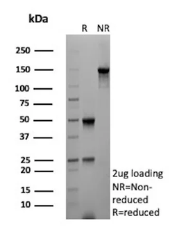 AKR1B1 Antibody