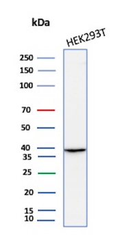 AKR1B1 Antibody