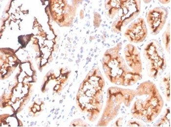 FABP1 Antibody
