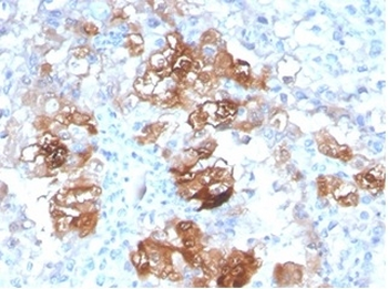 FABP1 Antibody