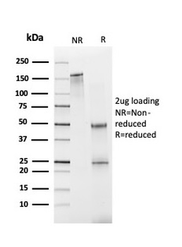 FABP1 Antibody