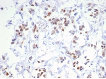 ESR1 Antibody
