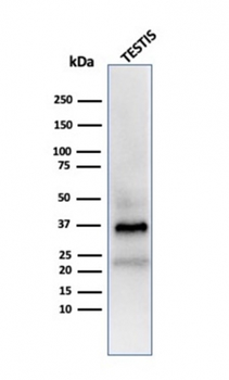 CLU Antibody