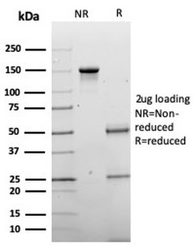 Chromogranin A / CHGA (Neuroendocrine Marker) Antibody