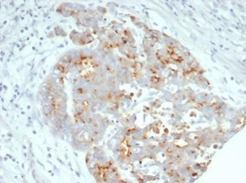 CFTR Antibody