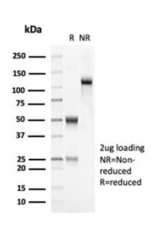 OLIG2 Antibody