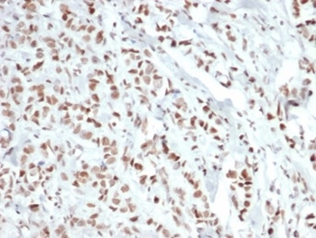 ESR1 Antibody