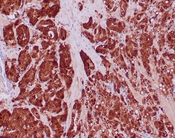 IDH1 Antibody