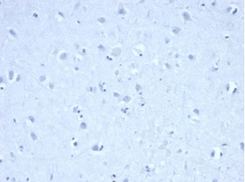 IDH1 Antibody