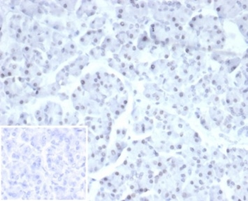 PHOX2B Antibody