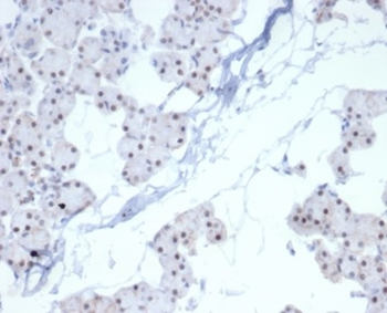 PHOX2B Antibody