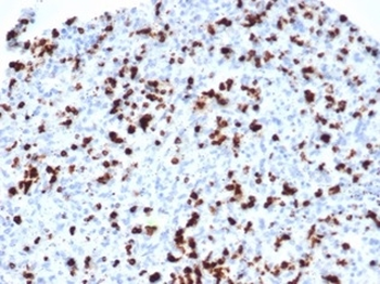 TIA1 Antibody