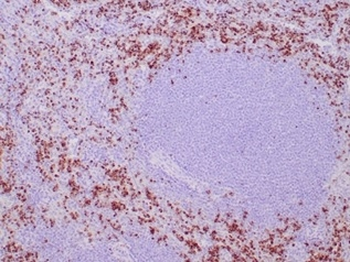 TIA1 Antibody