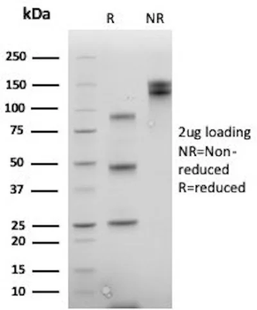 CDX2 Antibody