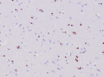 OLIG2 Antibody