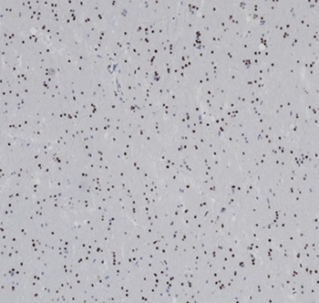 OLIG2 Antibody